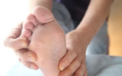Practical Solutions for Managing Diabetic Ulcer Treatment in Bel Air, MD for Faster Healing