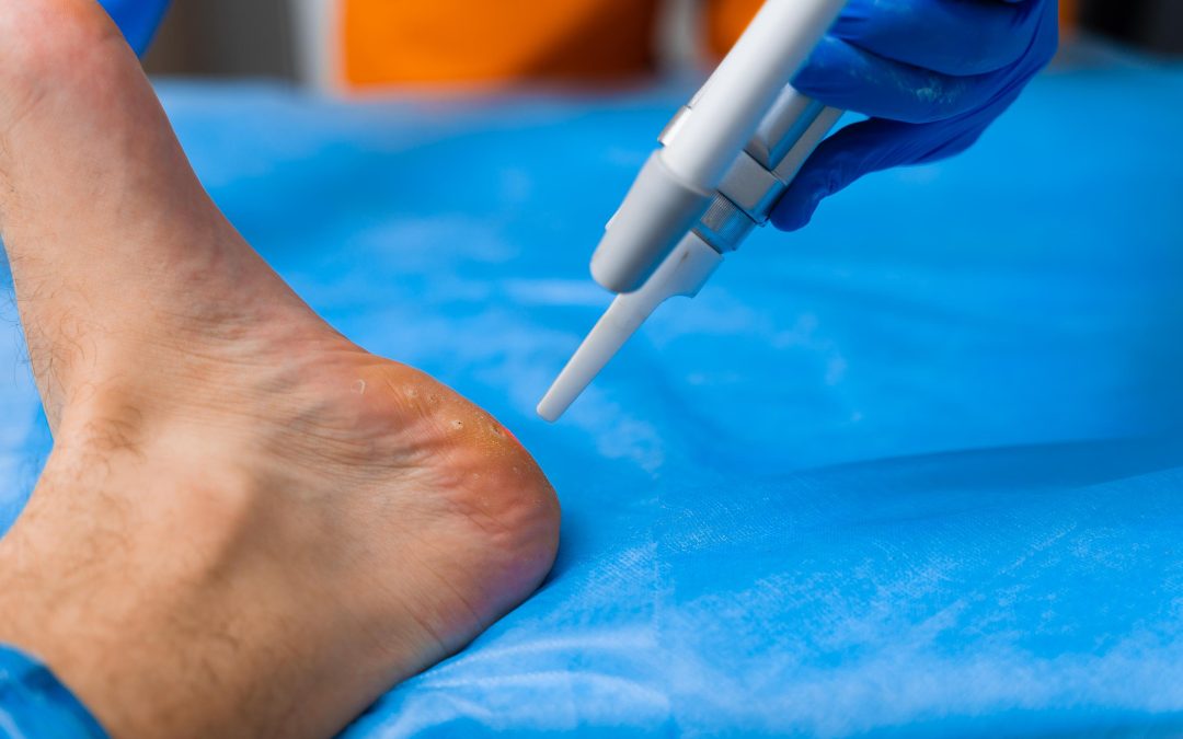 Restore Mobility Safely Utilizing Trusted Ankle Sprain Treatment in Bel Air MD